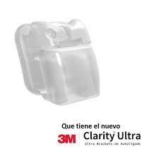 3M Unitek Clarity Ultra Ceramic Self-Ligating Bracket Kit